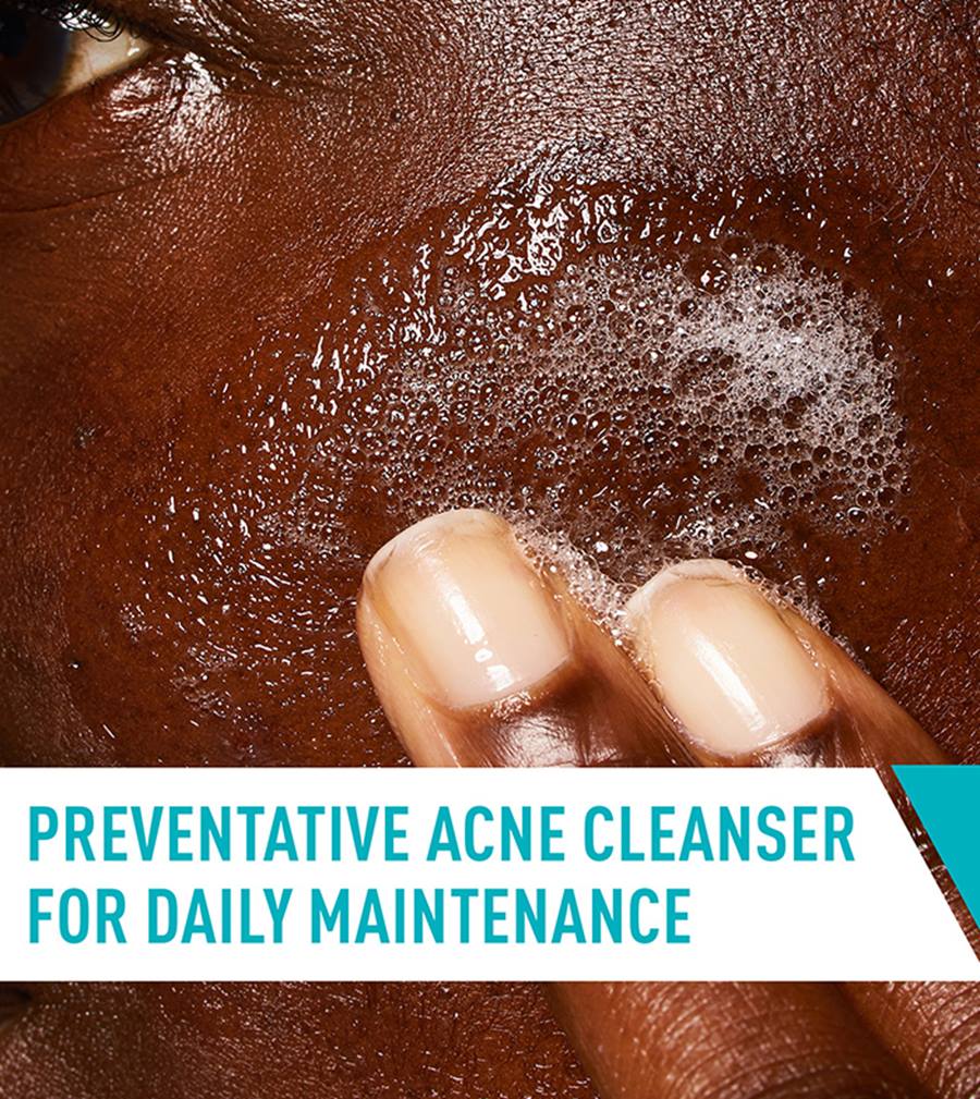 Cerave Acne Control Cleanser 2% SALICYLIC ACID ACNE TREATMENT 237ml